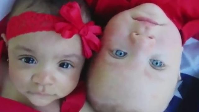 10 САМЫХ НЕОБЫЧНЫХ БЛИЗНЕЦОВ В МИРЕ смотреть онлайн