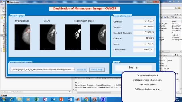 Classification of Mammogram Images using GLCM and Trace Transform Functionals смотреть онлайн