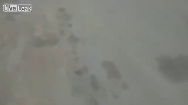 Удаление зуба по-русски. Челябинские стоматологи настолько суровы... смотреть онлайн