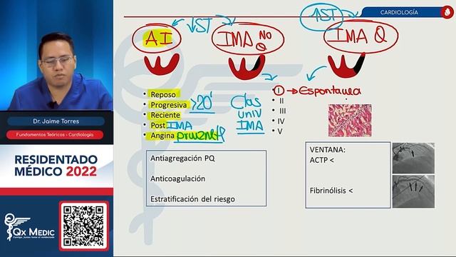 TEORÍA I - CARDIOLOGÍA смотреть онлайн