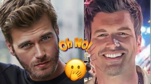 КЫВАНЧ ТАТЛЫТУГ СДЕЛАЛ ПЛАСТИЧЕСКУЮ ОПЕРАЦИЮ?🇹🇷