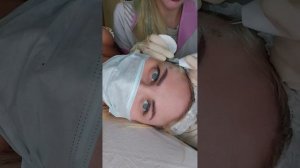 Удаление кератом папиллом родинок ручкой plasma pen