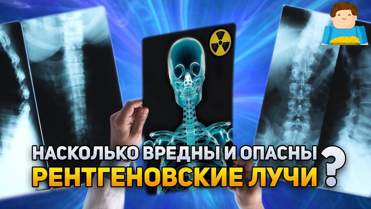 Насколько вреден рентген? | Plushkin смотреть онлайн