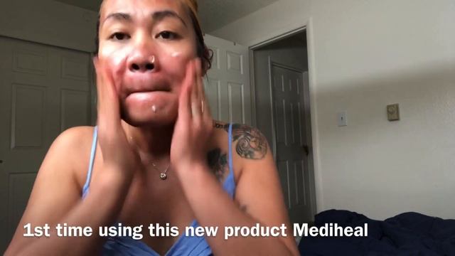 Mediheal Toner,Moisturizer And Serum 1st Time Using It For My Morning Skincare.(acnemarkproblem)