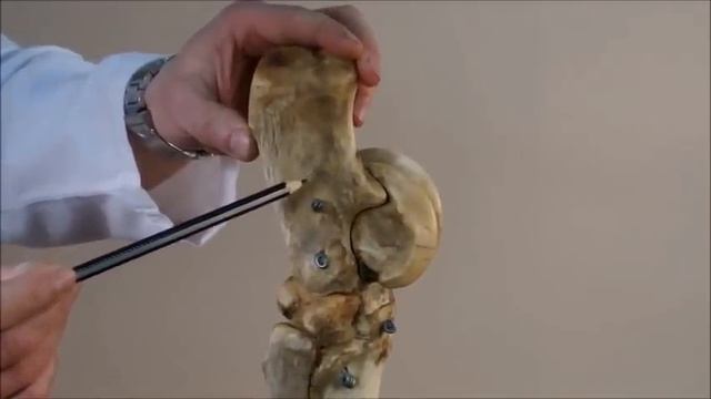 скелет стопы лошади смотреть онлайн