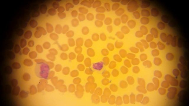 КЛЕТКИ КРОВИ под микроскопом! BLOOD CELLS under the microscope! смотреть онлайн