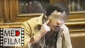 2. Дебильность,  агрессивность, патология речи © Imbecility, aggressiveness, speech pathology