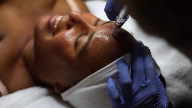 PHFormula Advanced Resurfacing MELA Peel At The DermaGuru | Ep. #3 | Hyperpigmentation & Dark Spots