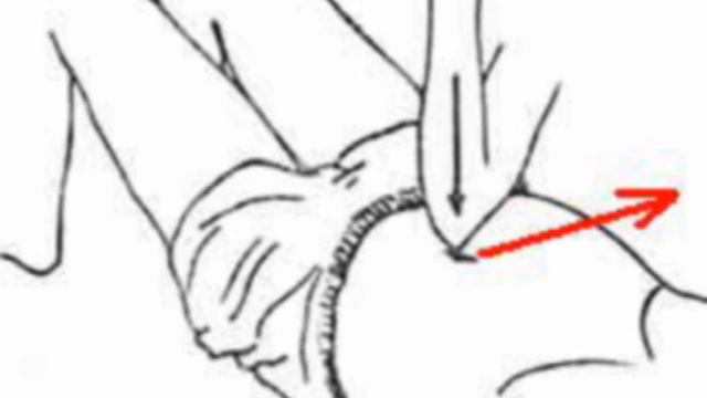 2. Лечение массажем славянского стиля. смотреть онлайн