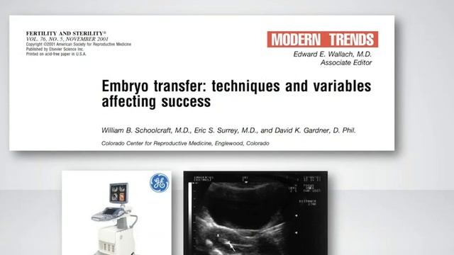 УЛУЧШЕНИЕ РЕЗУЛЬТАТОВ ПЕРЕНОСА С ИСПОЛЬЗОВАНИЕМ EMBRYOGLUE