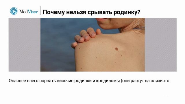 Почему нельзя срывать родинку? смотреть онлайн