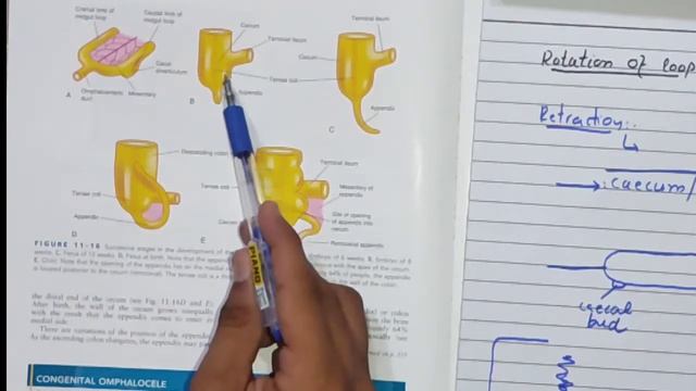 Development of Cecum and Appendix || Embryology of GIT смотреть онлайн
