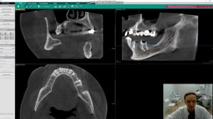как читать компьютерную томографию