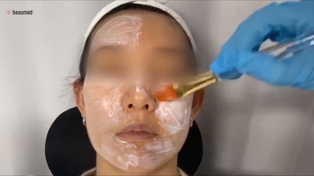 Live Demo : Mi-Caine Lido смотреть онлайн