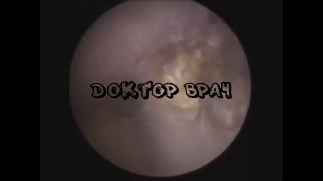 СУХАЯ УШНАЯ СЕРА! ТАКОГО ТЫ ЕЩЁ НЕ ВИДЕЛ!