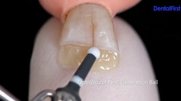 Система IPS Empress Direct