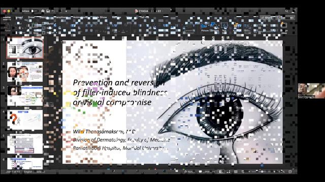 [Teaser] How Experts Avoid and Manage Vascular Accidents of Filler Injection смотреть онлайн