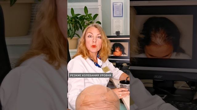 Почему я лысею?