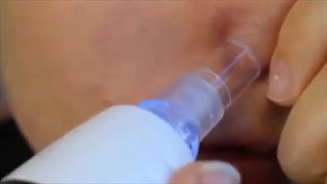 как убрать черные точки смотреть онлайн