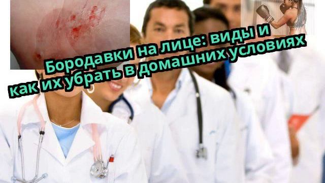 Бородавки на лице: виды и как их убрать в домашних условиях смотреть онлайн