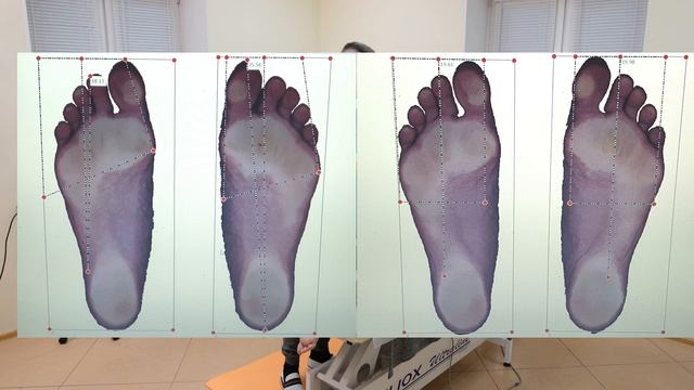 Стопы и стройность ног зависят от позвоночника и положения таза смотреть онлайн