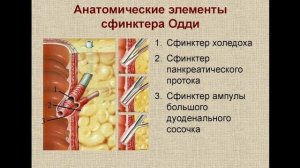Удаление камней из желчных протоков. ЭРХПГ.