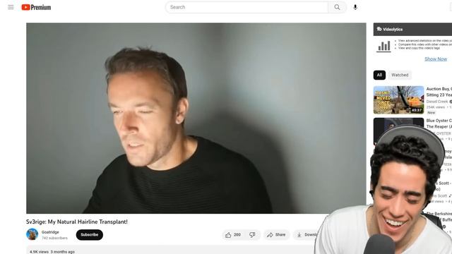 Sv3rige HairlineMAXXING to DITCH THE BALDIVORES! смотреть онлайн