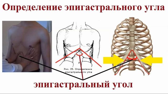 Типы конституций человека смотреть онлайн