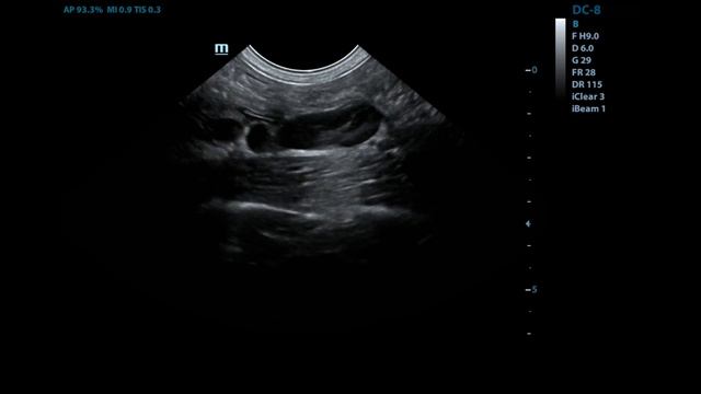 спленоренальный шунт у собаки смотреть онлайн