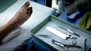 Пачка Гангрена