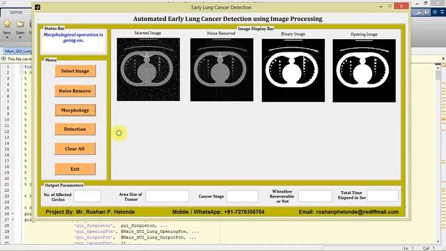Matlab Project for Early Lung Cancer Detection Using Image Processing Full Source Code смотреть онлайн