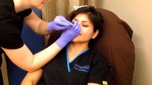 Imagen Body Sculpting Dysport Injection смотреть онлайн