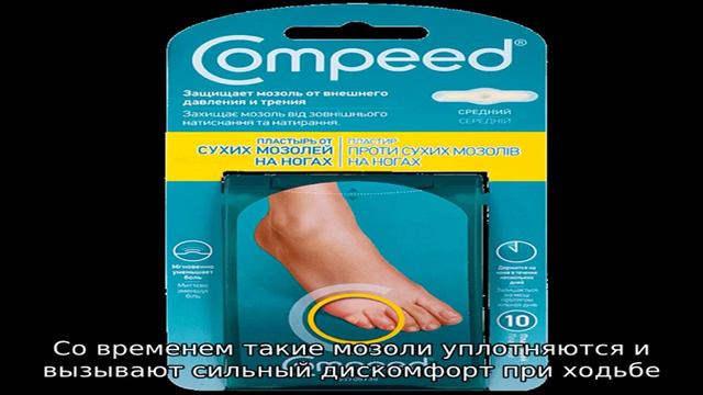 Что делать, если у ребенка появилась мозоль на ноге: методы лечения и профилактики смотреть онлайн