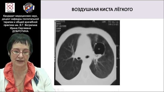 Дифференциальная диагностика очаговых поражений легких. Демо-версия