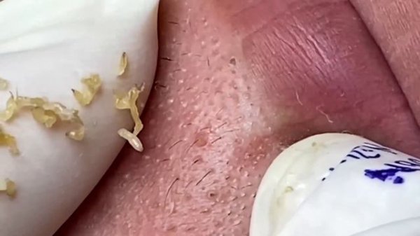 Enjoy Your Day With Hien Nguyen Spa # 1322