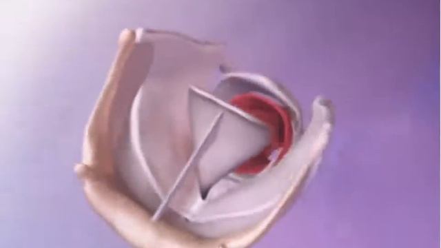 Надгортанник смотреть онлайн