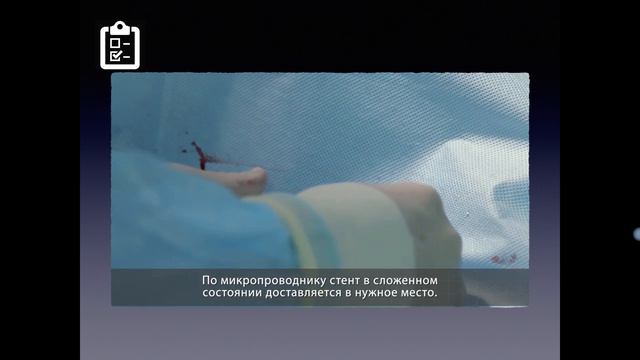 ИБС_1 смотреть онлайн