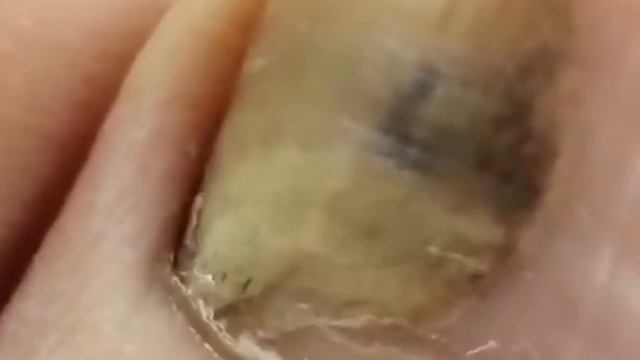 Ваше здоровье .Какими свойствами обладают касторовое масло и сода? смотреть онлайн