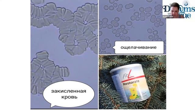 Бизнес Презентация немецкой компании PM International ? смотреть онлайн
