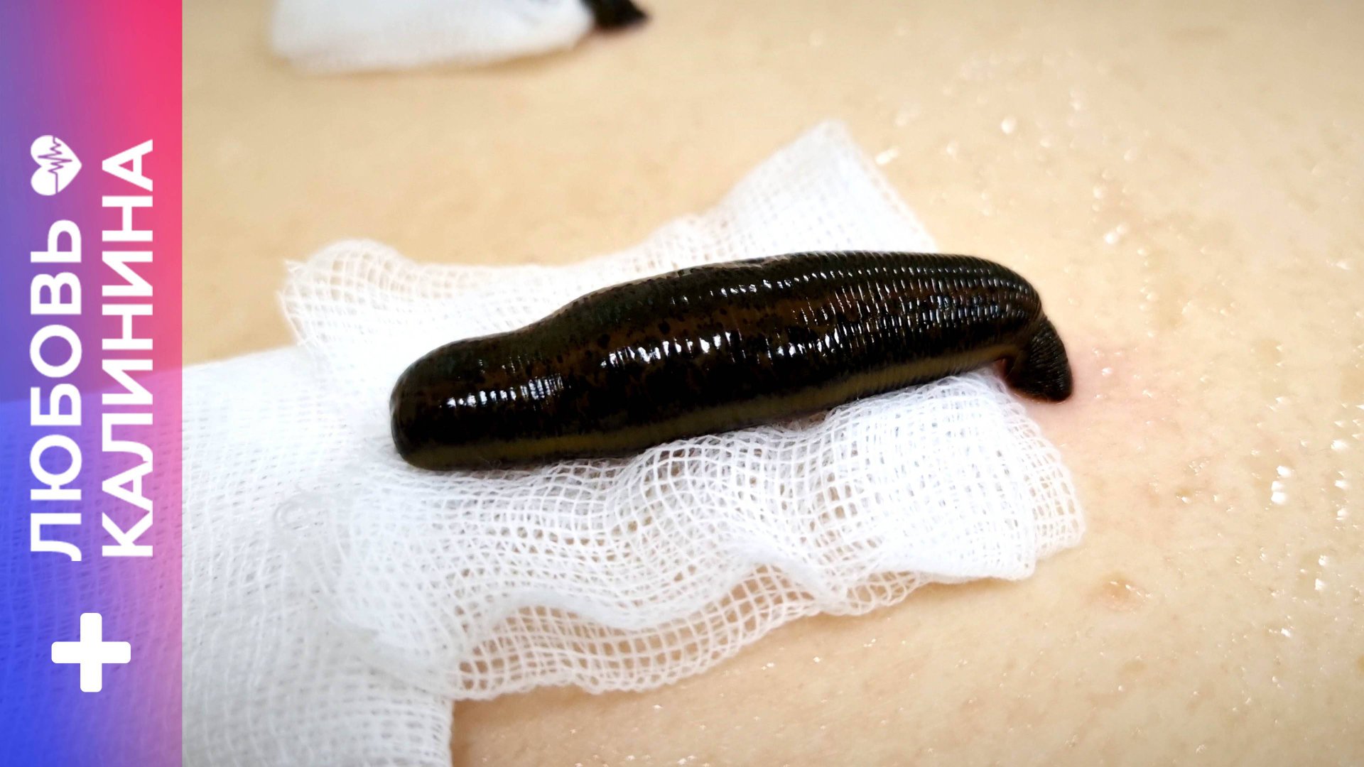 09. Пиявки. Применение. Гирудотерапия | Л.Калинина смотреть онлайн