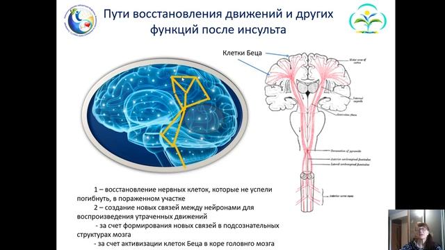 Психология восстановления после инсульта. Как поможет собственное сознание в реабилитации. Часть 1 смотреть онлайн