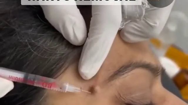 Excel Skin-Hair-Laser Clinic/ Warts Treatment / Laser Treatment / Skin Treatment / Excel Skin Car смотреть онлайн