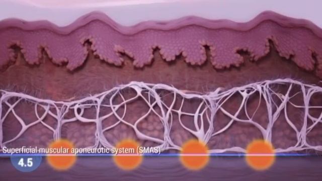4D Hifu Lifting ohne OP Fokuslu ultrason Ameliyatsiz yüz germe TkBeauty смотреть онлайн