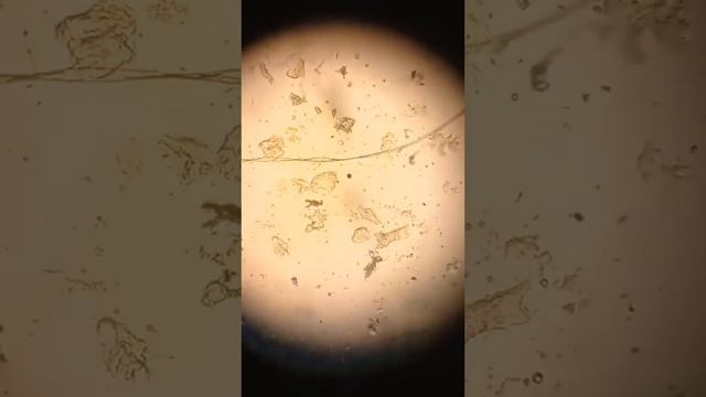 Проверка рыбы на описторхоз смотреть онлайн