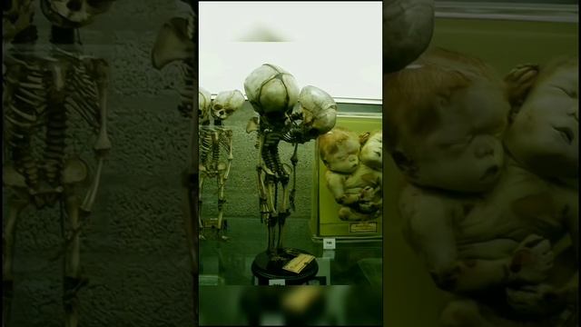 Музей в Котором Хранят Части Тела Человека!? #shorts #музей #тело смотреть онлайн