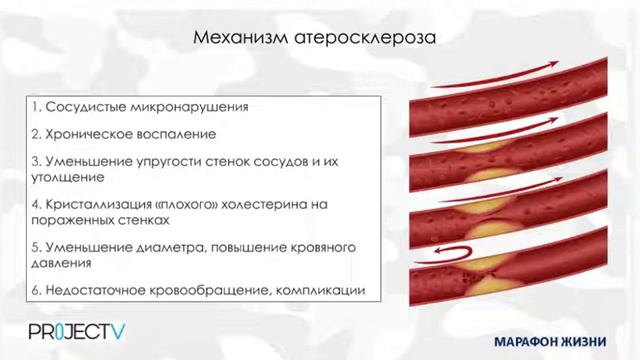 2022 11 26 -Л.Швейцер, Марафон жизни- Сердечно сосудистая система, как основа здоровья человека смотреть онлайн