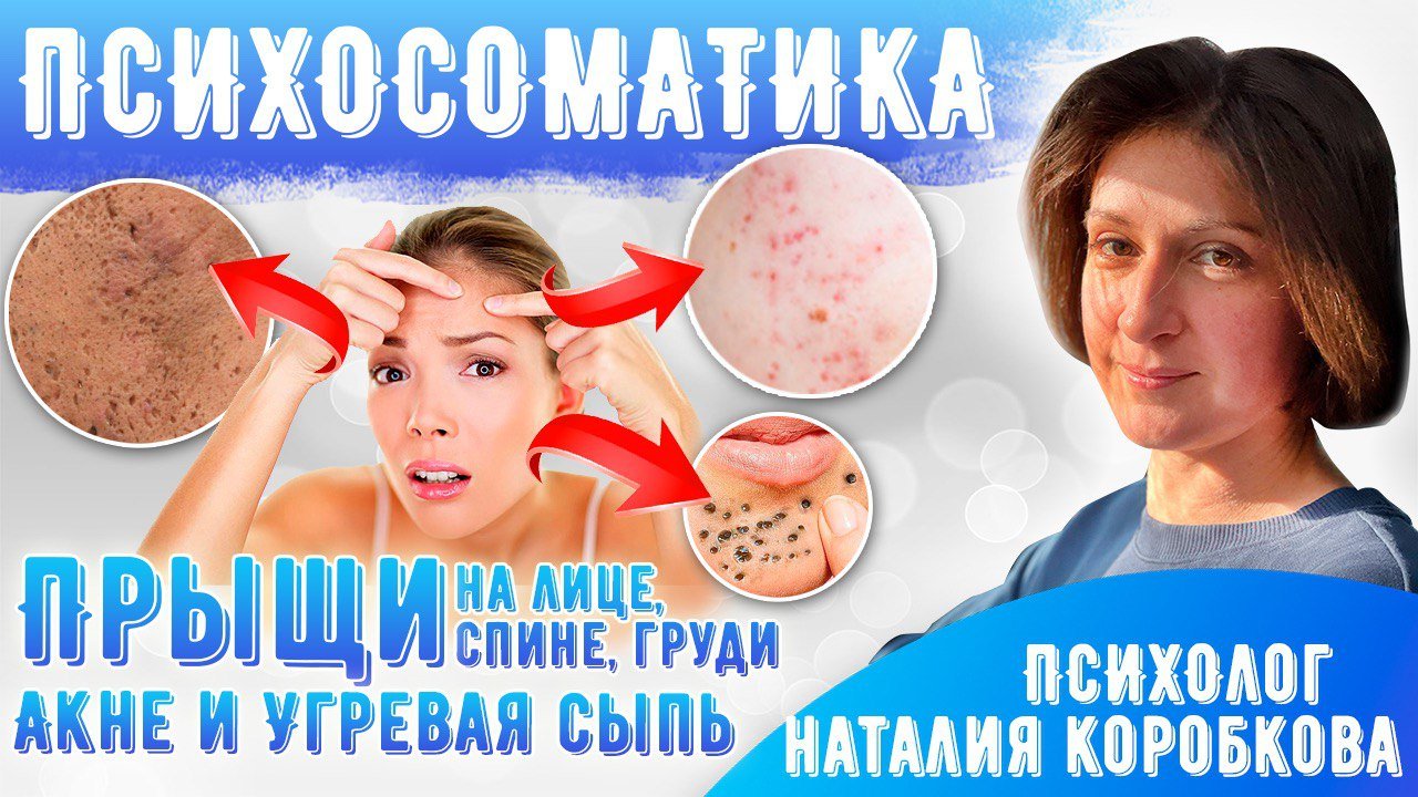 Акне, прыщи Психосоматика. смотреть онлайн