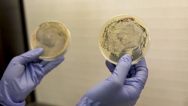 Analysis of Staphylococcus spp. in food samples youtube смотреть онлайн