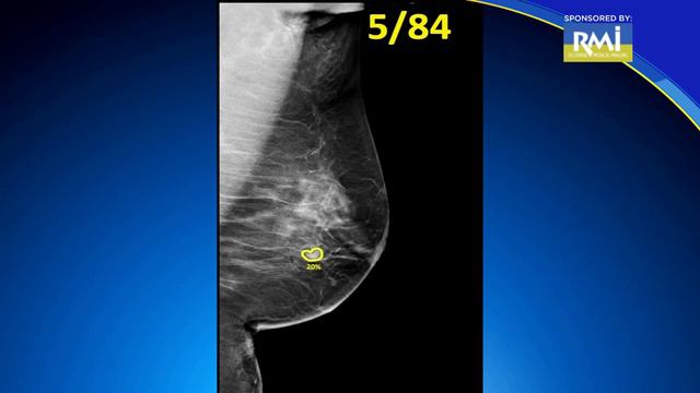 ProFound AI at RMI смотреть онлайн