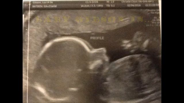 Baby Gibson Announcement смотреть онлайн